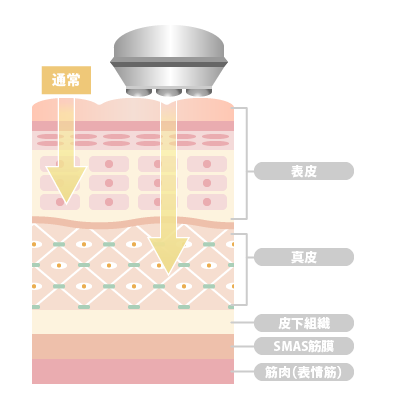 複合方美容機 SB CABIN 2｜日本セルフエステ協会