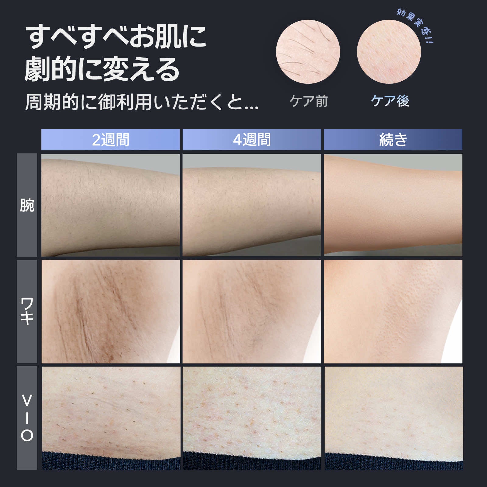 公式】Ulike Air 2 Men IPL光美容器 | Ulike脱毛器​・家庭用脱毛器