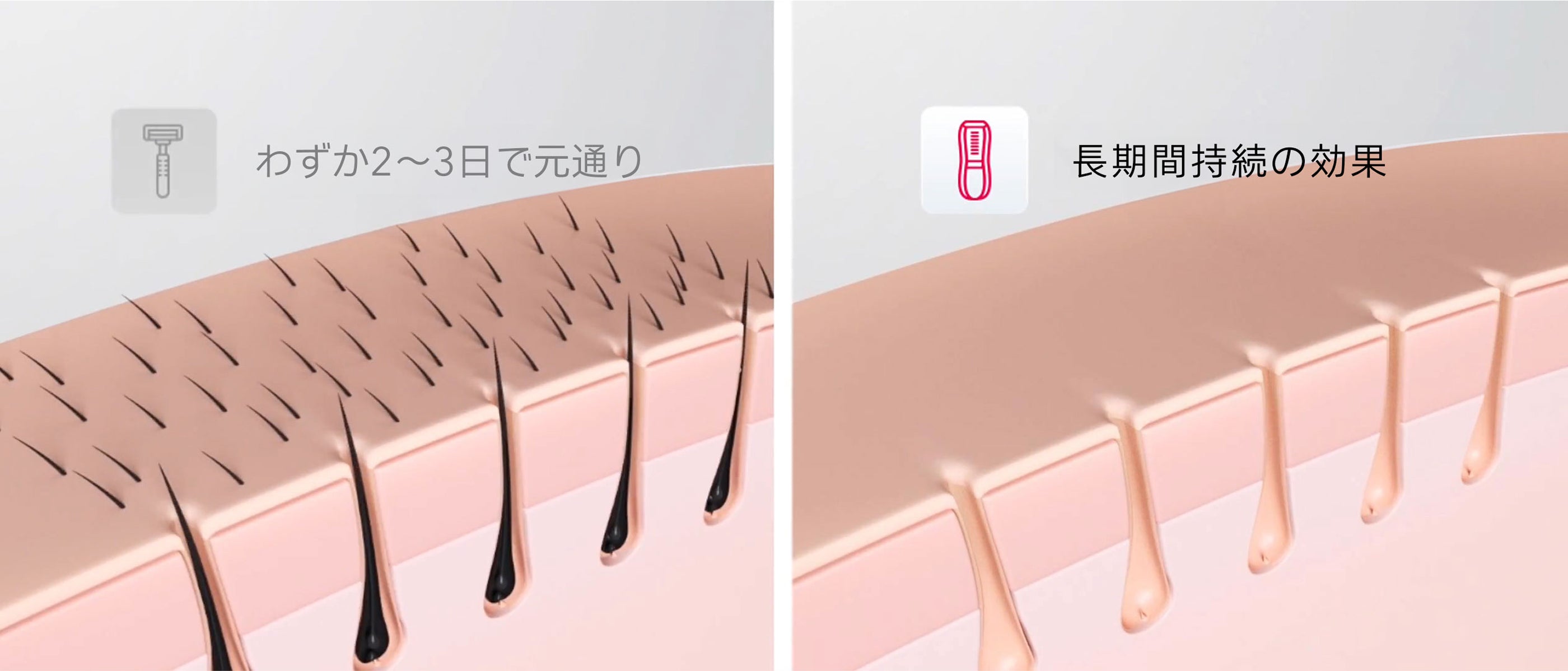 公式】Ulike（ユーライク）脱毛器・ 光美容器のIPL技術について