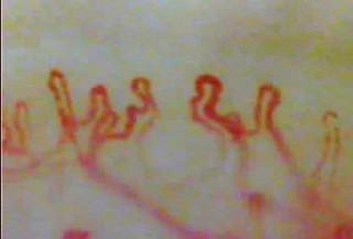 毛細血管スコープSC-10 – あっと株式会社