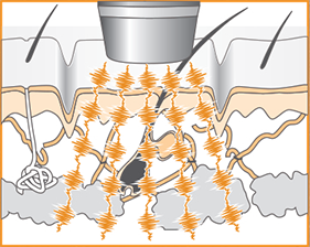 イーポレーション・イージーエムミニ | ユニッシュlx．