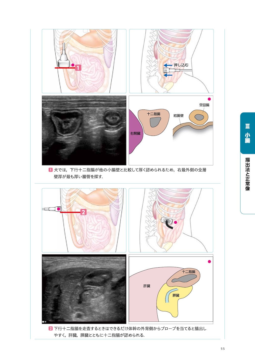 画像とシェーマで学ぶ犬と猫の超音波 Vol.2 腹部 上巻 | 臨床獣医学