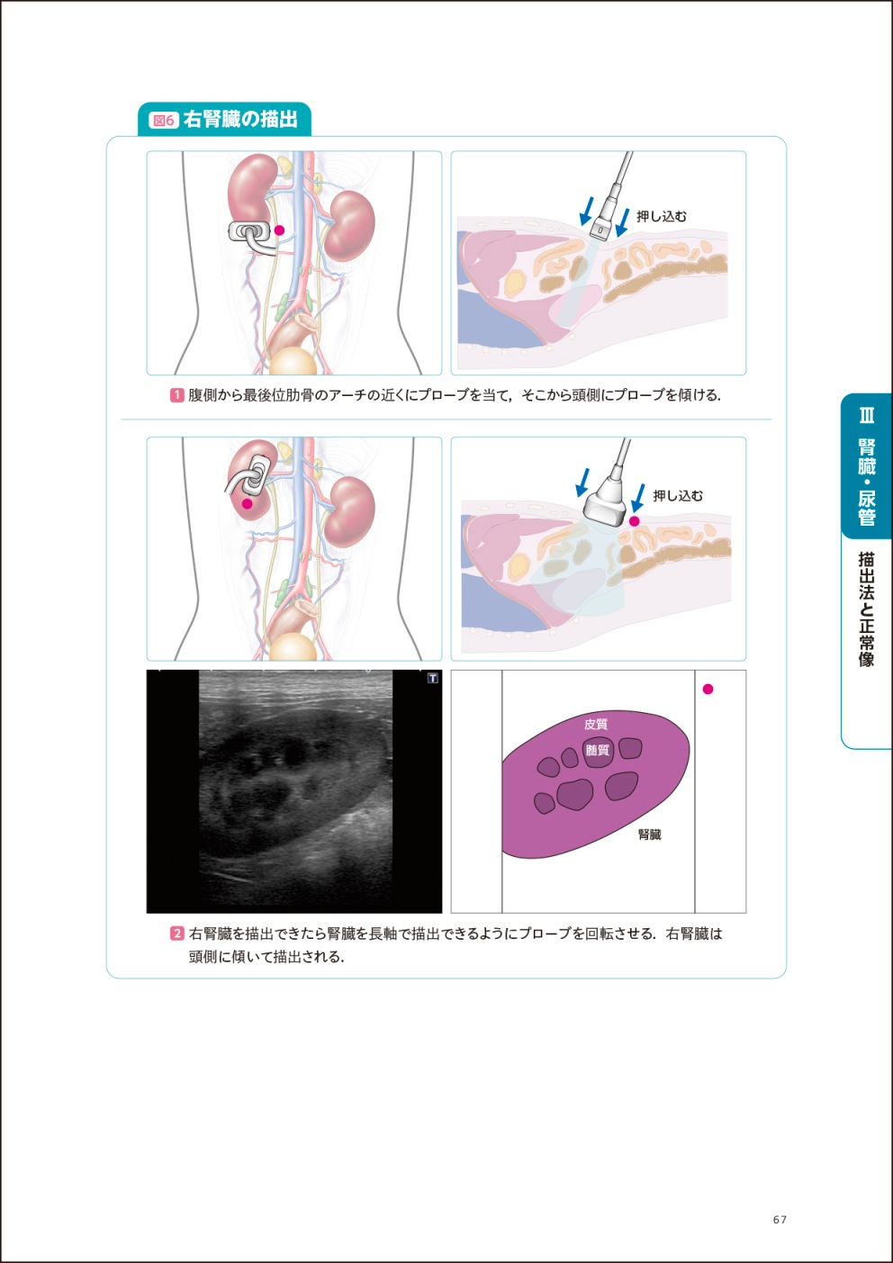 画像とシェーマで学ぶ犬と猫の超音波 Vol.3 腹部 下巻 | 臨床獣医学