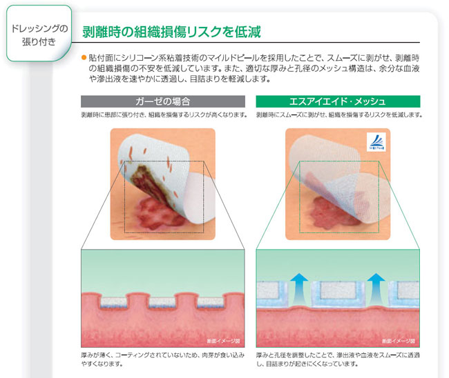 アルケアエスアイエイド・メッシュ通販｜ピースケア