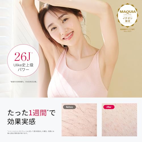 Ulike - 脱毛器 Air10 光美容器 の評価 | SHOPSTAFF