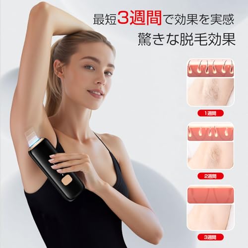 Veoyads - CRYSTAL HIPL 光脱毛器 の評価 | SHOPSTAFF