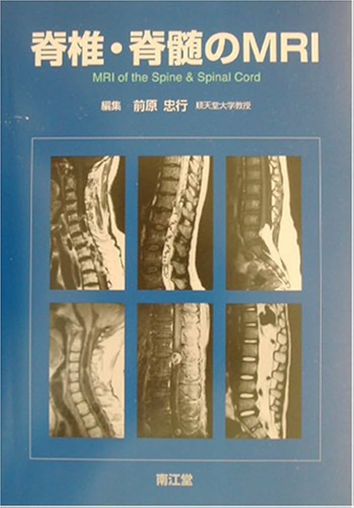 脊椎・脊髄のMRI | 前原忠行 |本 | 通販 | Amazon