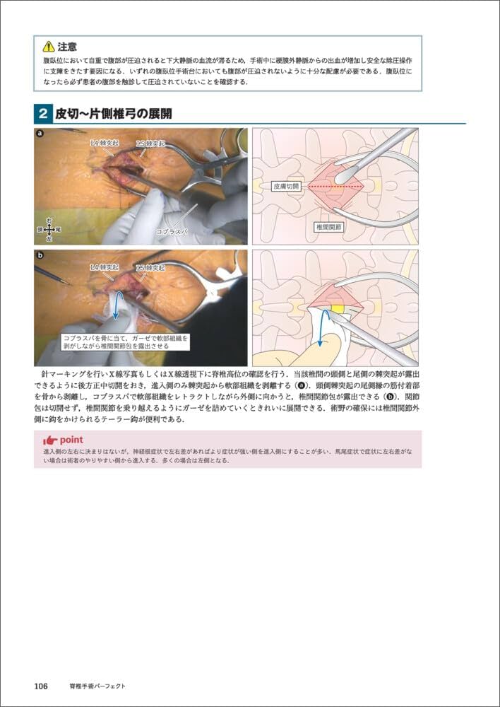 脊椎手術パーフェクト〜術前準備から展開、除圧、固定、閉創まで術中