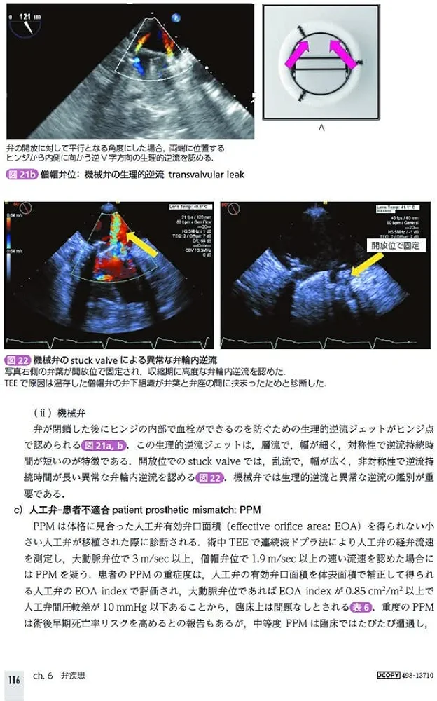Amazon.co.jp: TEE試験対策ガイド ―JB-POT・心エコー図専門医試験徹底