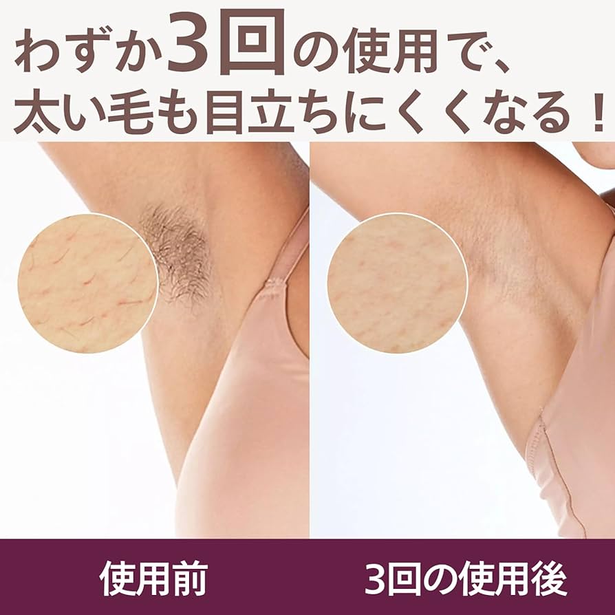 Amazon | 【正規品】フィリップス 光美容器 ルメア アドバンス メンズ