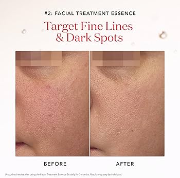 Amazon.com: SK-II Ultimate Aura Skincare Kit - Radiance-Boosting