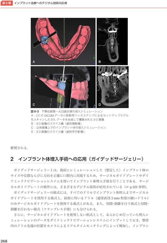 717LpaYGyPL._AC_UF1000,