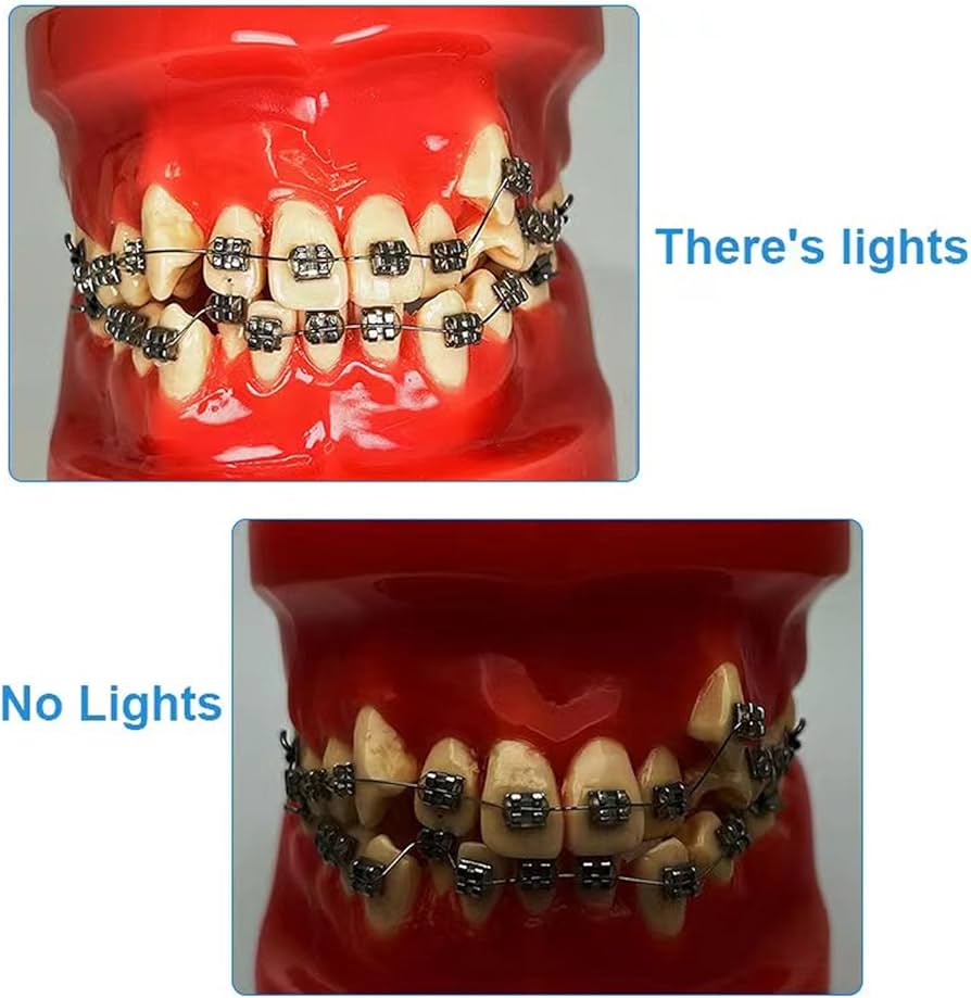 Amazon.co.jp: 歯科写真撮影ライト、口腔携帯電話カメラ補助光、歯科