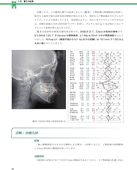 実践的リンガルブラケット矯正 | 松野 功 |本 | 通販 | Amazon