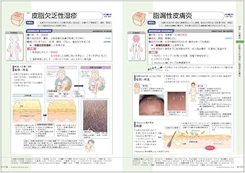 病気がみえる vol.14 皮膚科 第1版 | 医療情報科学研究所 |本 | 通販