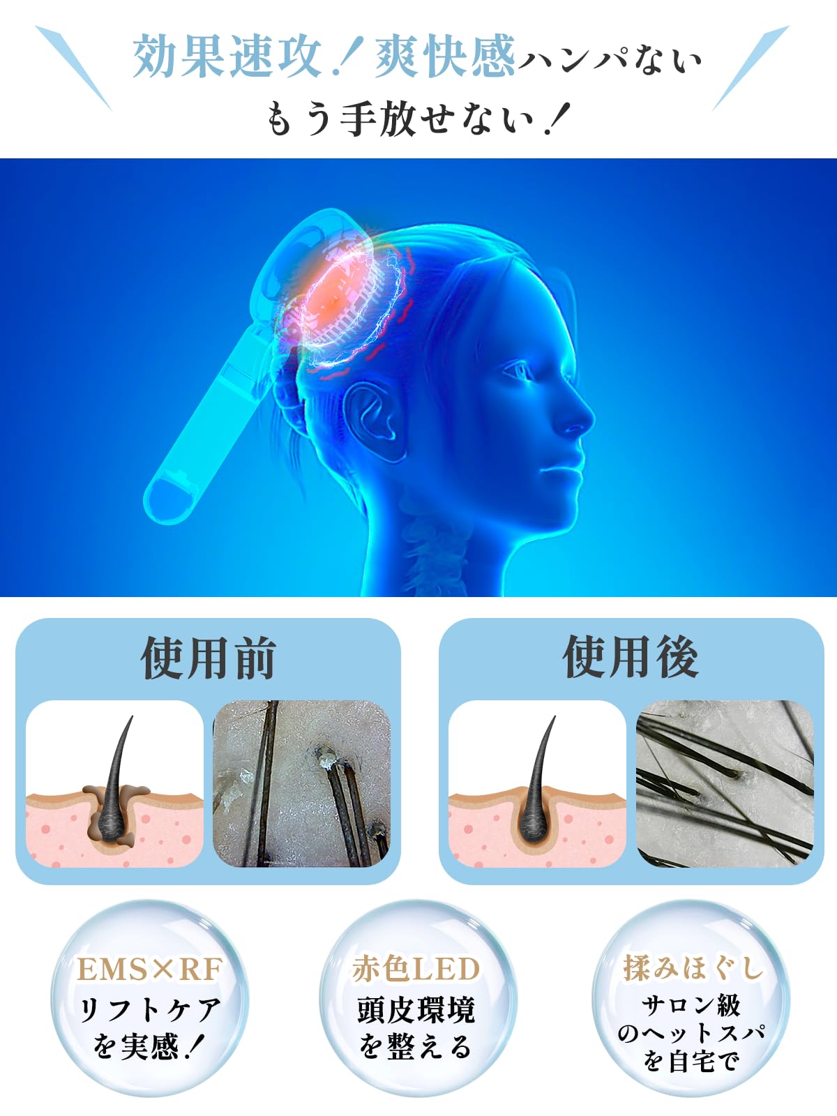 Amazon.co.jp : Kiboer 電気ブラシ ヘッドスパ 電動頭皮ブラシ