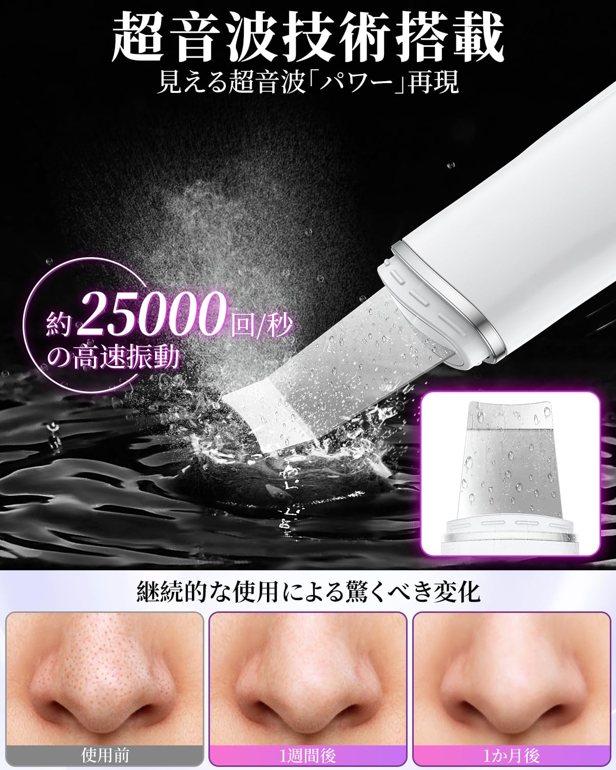 Amazon.co.jp: ウォーターピーリング 美顔器 超音波ピーリング 【磁気