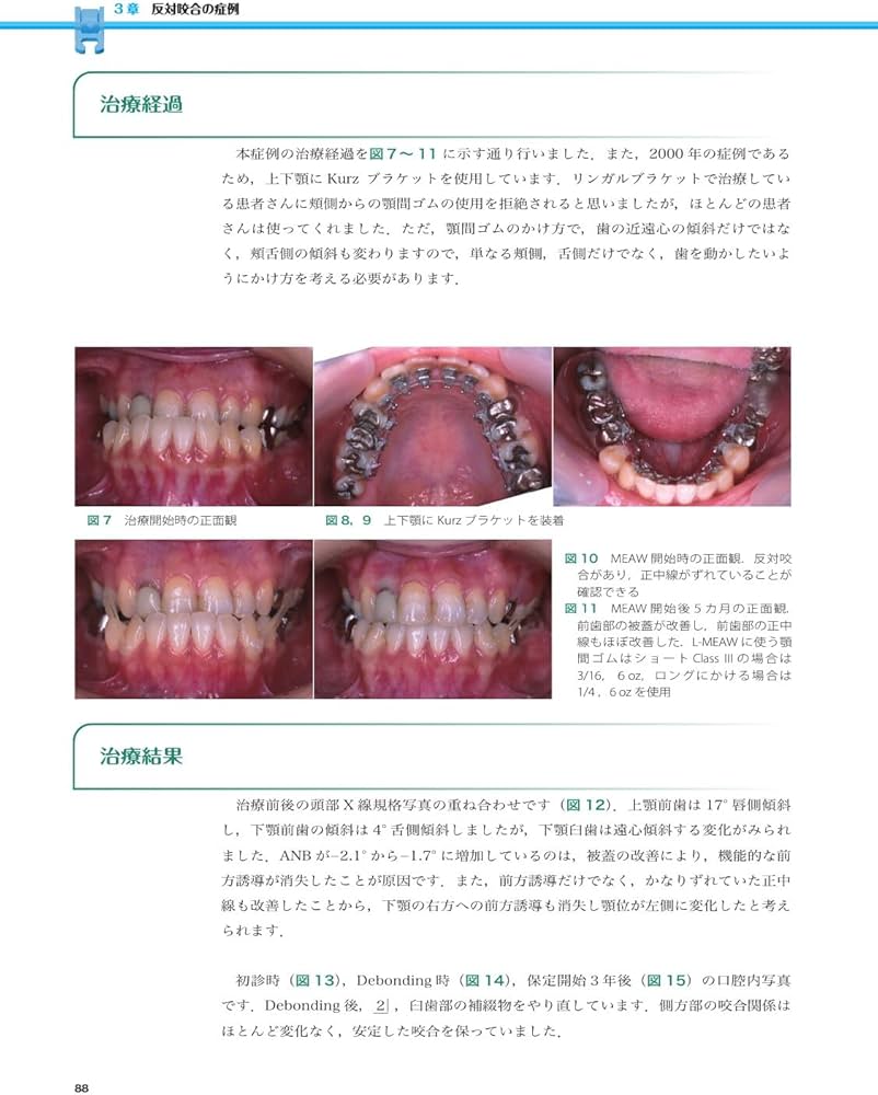 71NVPEICO0L._AC_UF1000,