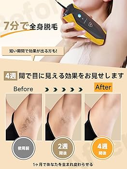 Amazon | JOVS脱毛器 メンズ レディース vio対応 【SGS最優秀