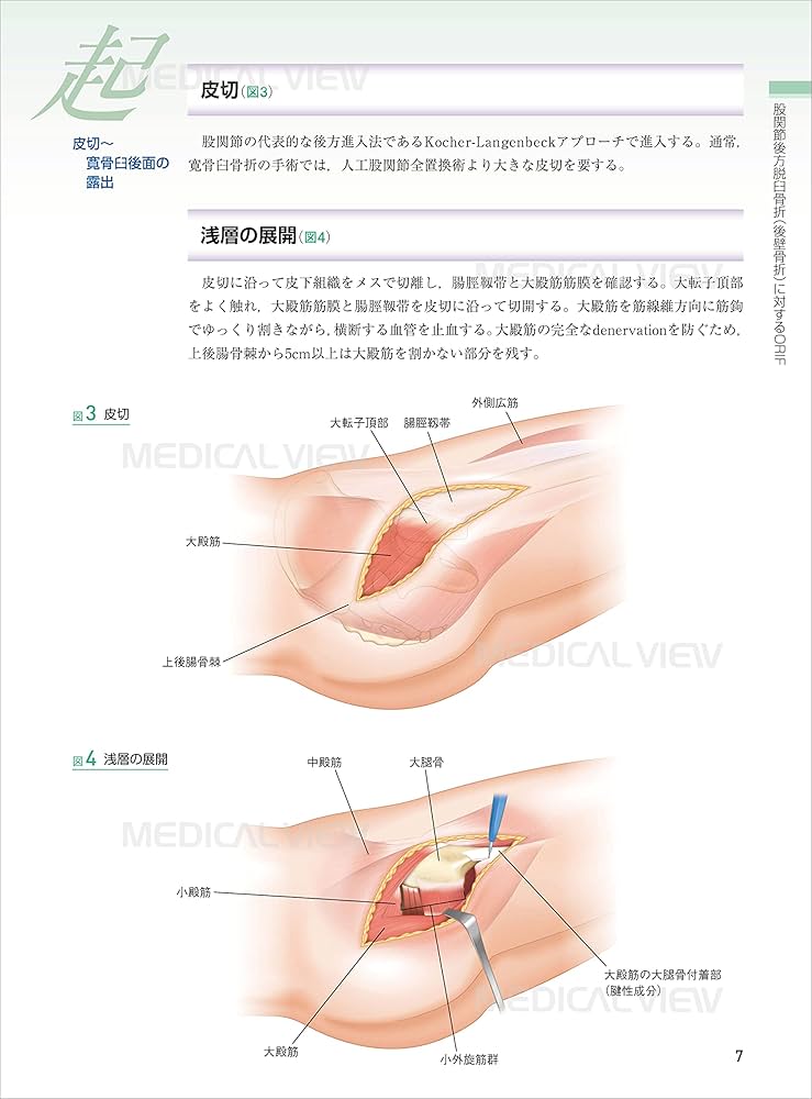 下肢 (新 執刀医のためのサージカルテクニック) | 齋藤 修 |本 | 通販