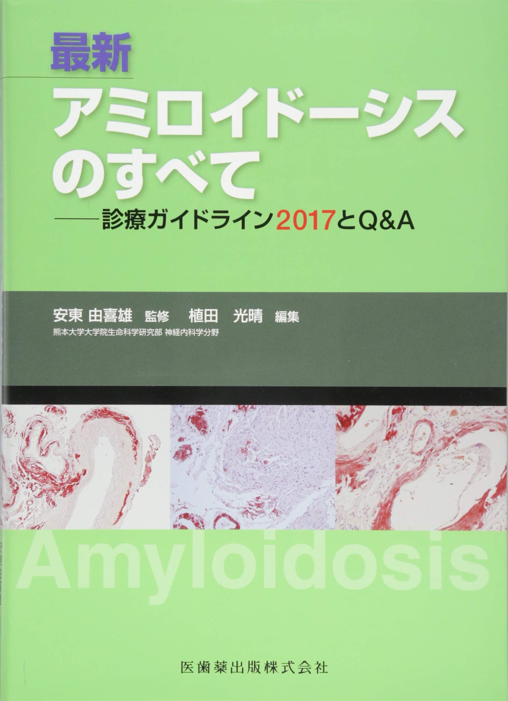 最新 アミロイドーシスのすべて 診療ガイドライン2017とQ&A | 安東