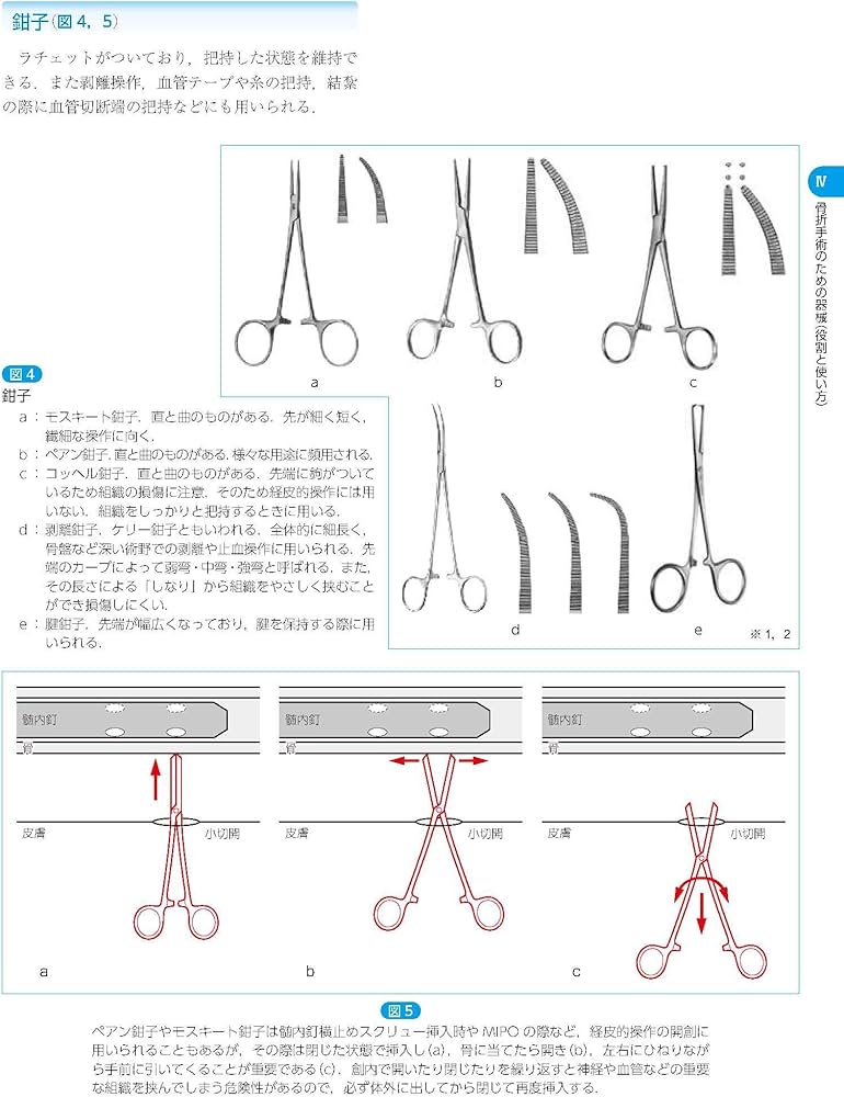 骨折治療基本手技アトラス~押さえておきたい10のプロジェクト | 最上