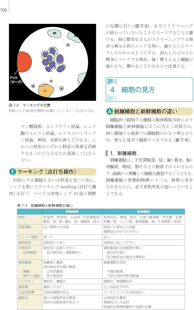 Amazon.com: 細胞診を学ぶ人のために 第6版: 9784260037990: Atuhiko