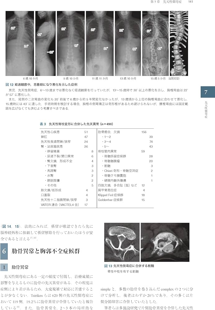 Amazon.co.jp: 症例から学ぶ小児脊柱変形（基礎から難治性疾患まで