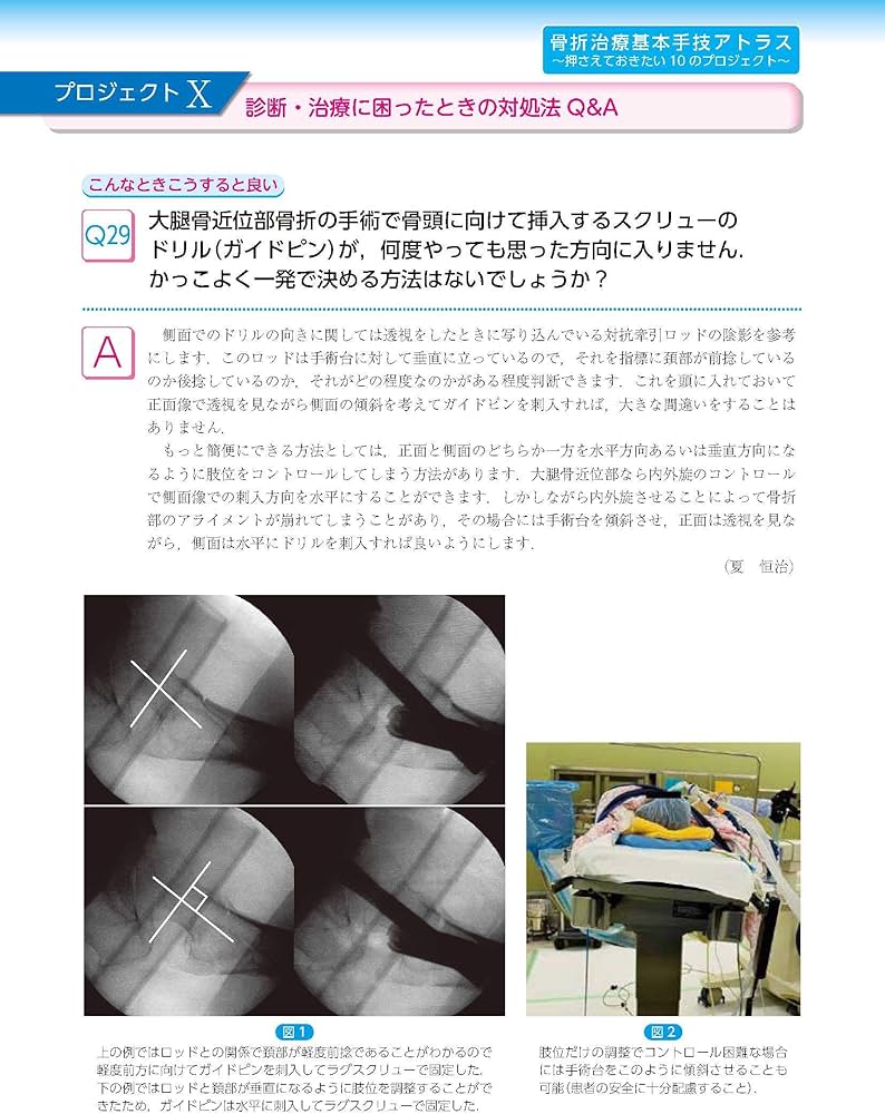 骨折治療基本手技アトラス~押さえておきたい10のプロジェクト | 最上