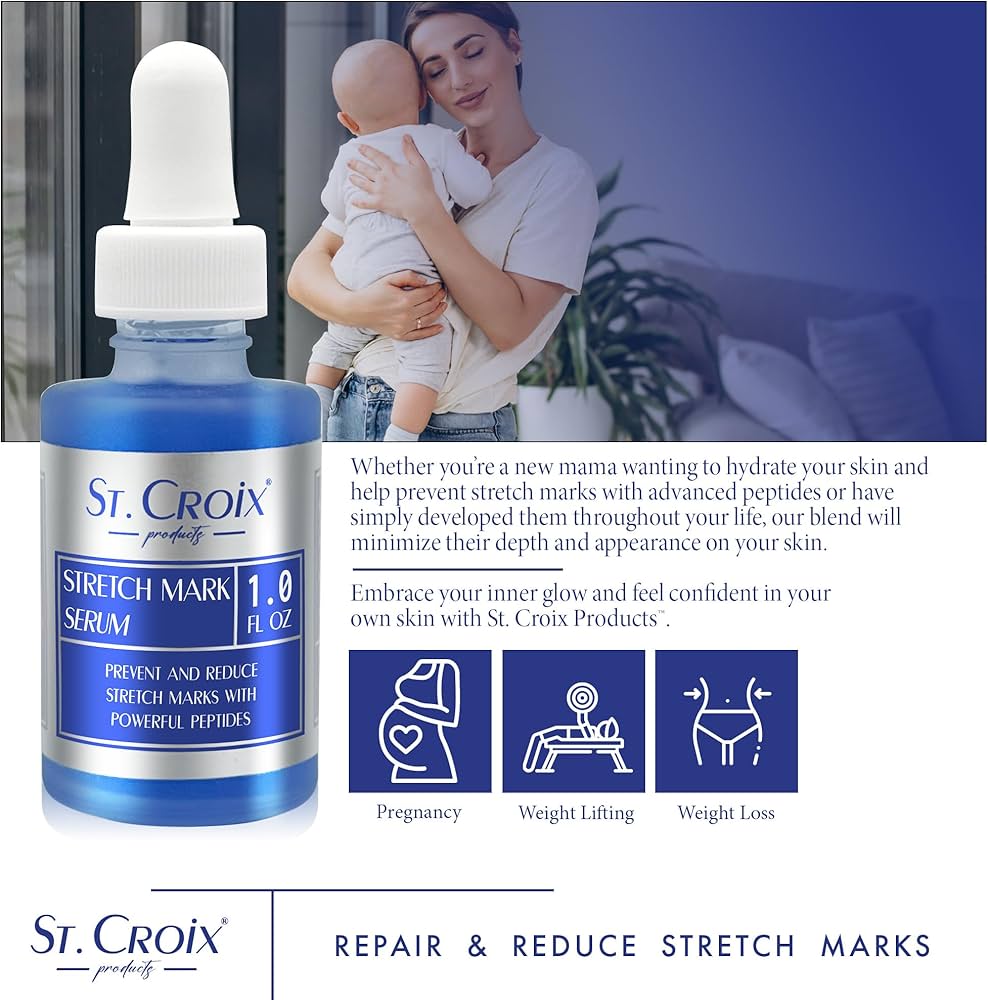 Amazon.com : Stretch Mark Serum - Prevent and Reduce Appearance of