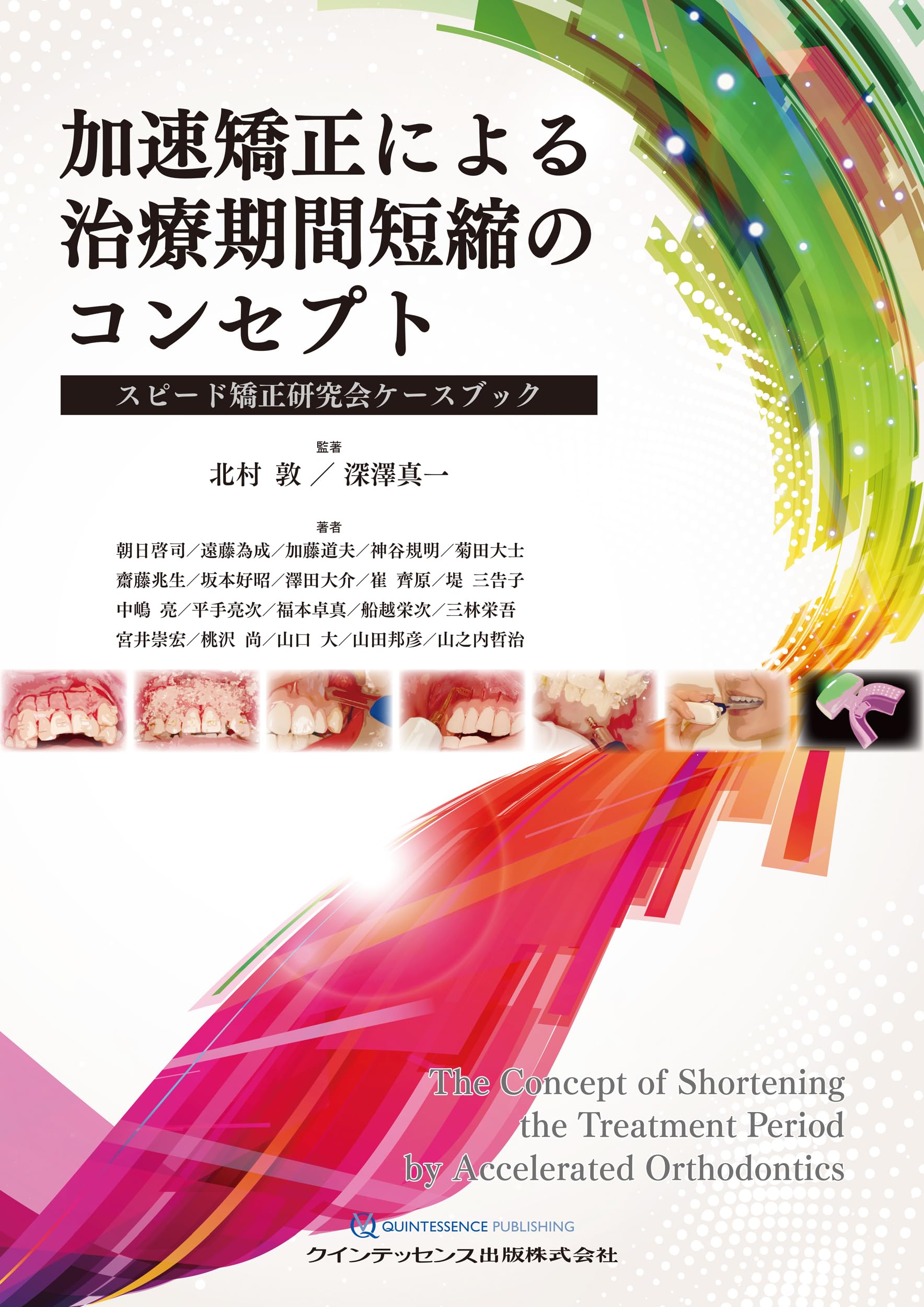 加速矯正による治療期間短縮のコンセプト: スピード矯正研究会ケース