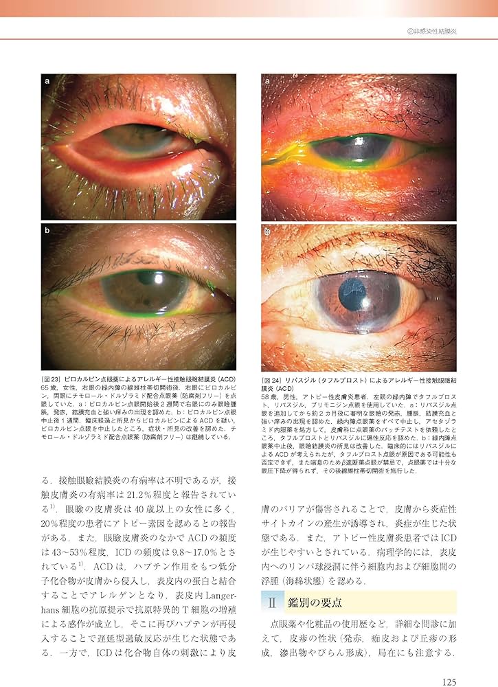 眼科診療ガイド 第2版 | 根木 昭 |本 | 通販 | Amazon