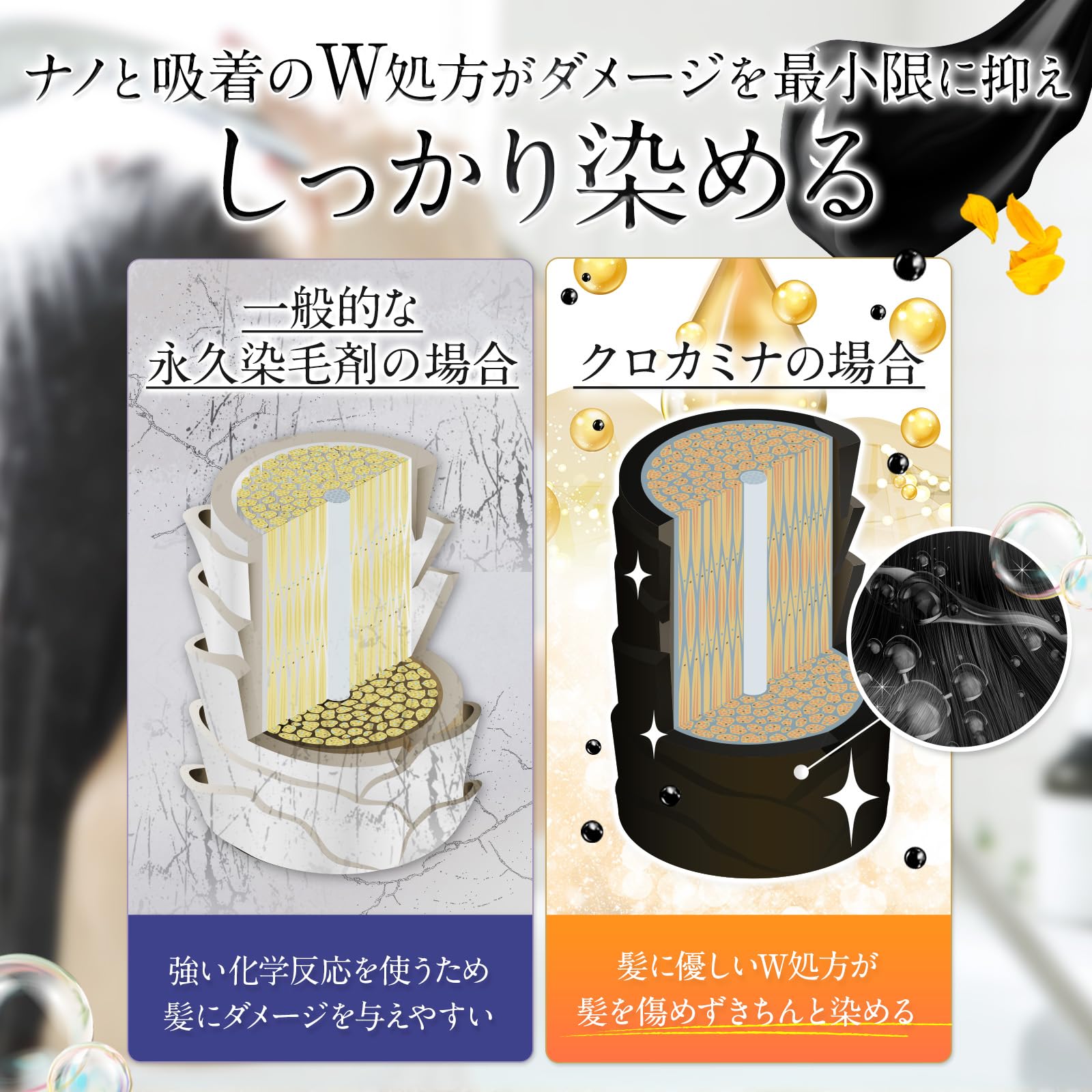 Amazon | 【AGAクリニック×製薬会社 共同開発】KUROKAMINA クリーム