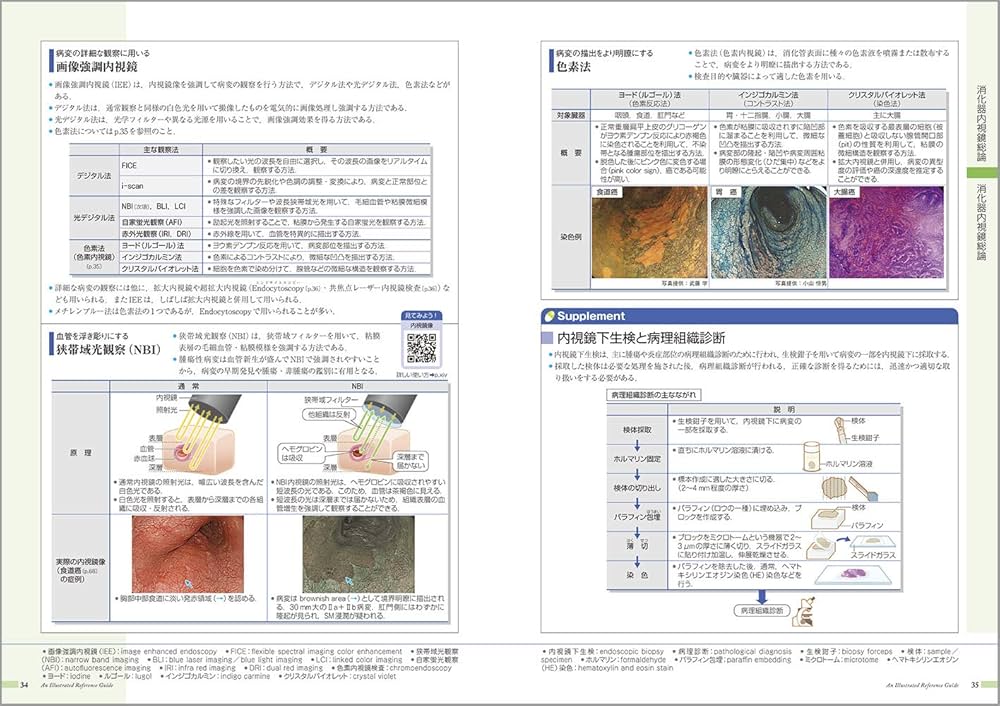 病気がみえる vol.1 消化器 第6版 | 医療情報科学研究所 |本 | 通販