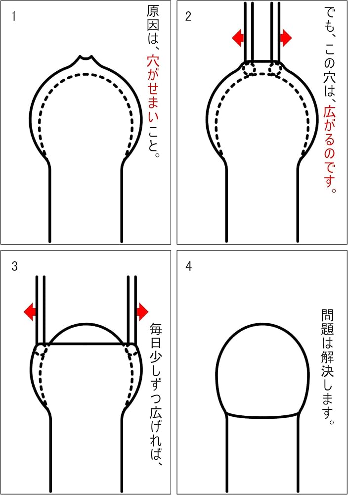 Amazon.co.jp: キトー君dx＋st(メーカー直販): ドラッグストア