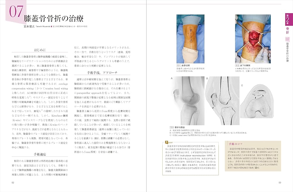 膝の外傷：診断・適応・手術 (整形外科SURGICAL TECHNIQUE BOOKS 14