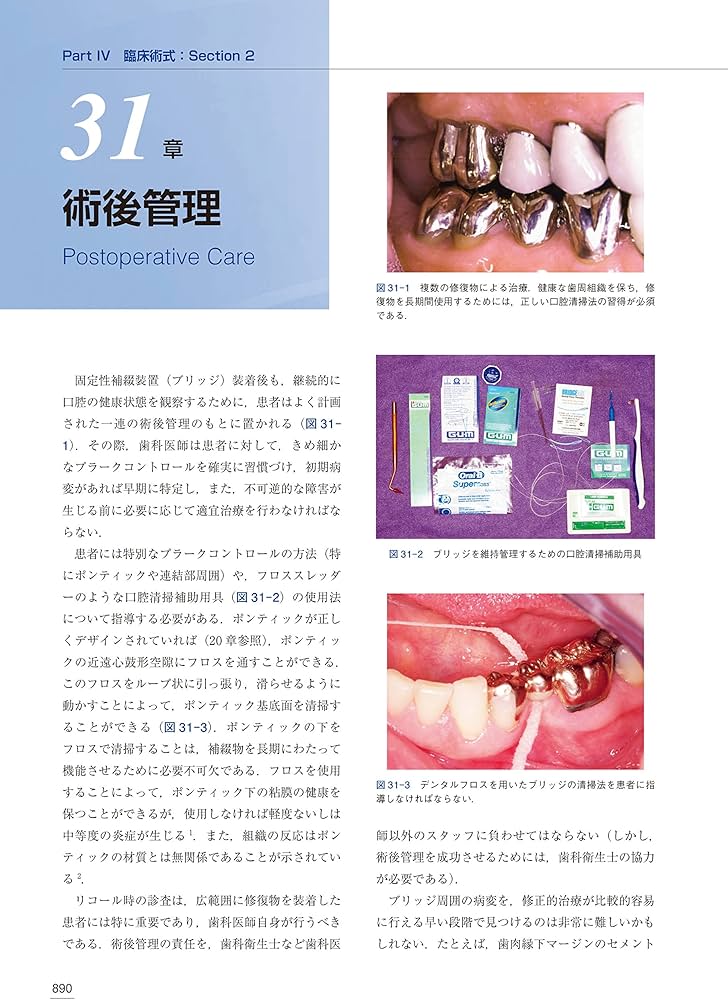 クラウンブリッジの臨床 原著第5版 | Stephen F.Rosenstiel, Martin f