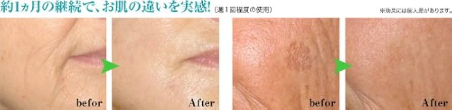 Amazon.co.jp: ドクターズ・ダイヤモンドピーリング本体セット