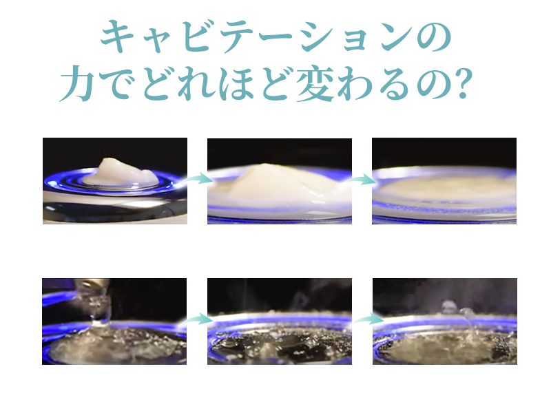 Amazon.co.jp: Kiboer 美顔器 RF美顔器 トータルケア フェイス ボディ