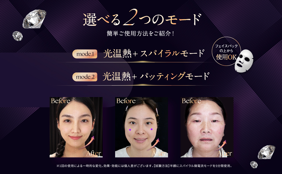 Amazon.co.jp: NOWMI LAB スパイラルケア美顔器 STORM : ホーム＆キッチン