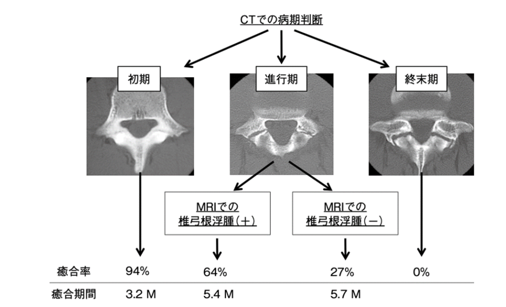 腰椎分離症の症状、原因、治療 | 桃谷うすい整形外科｜大阪天王寺JR
