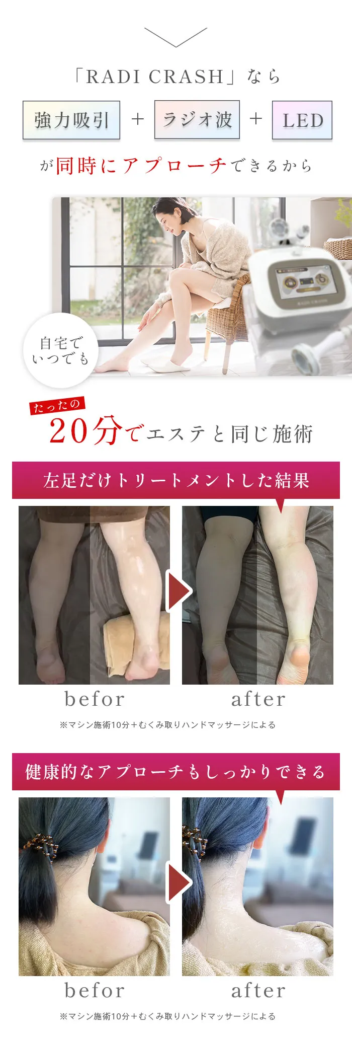 RADI CRUSH|1MHzマルチポーラ式ラジオ波と強力吸引で圧倒的