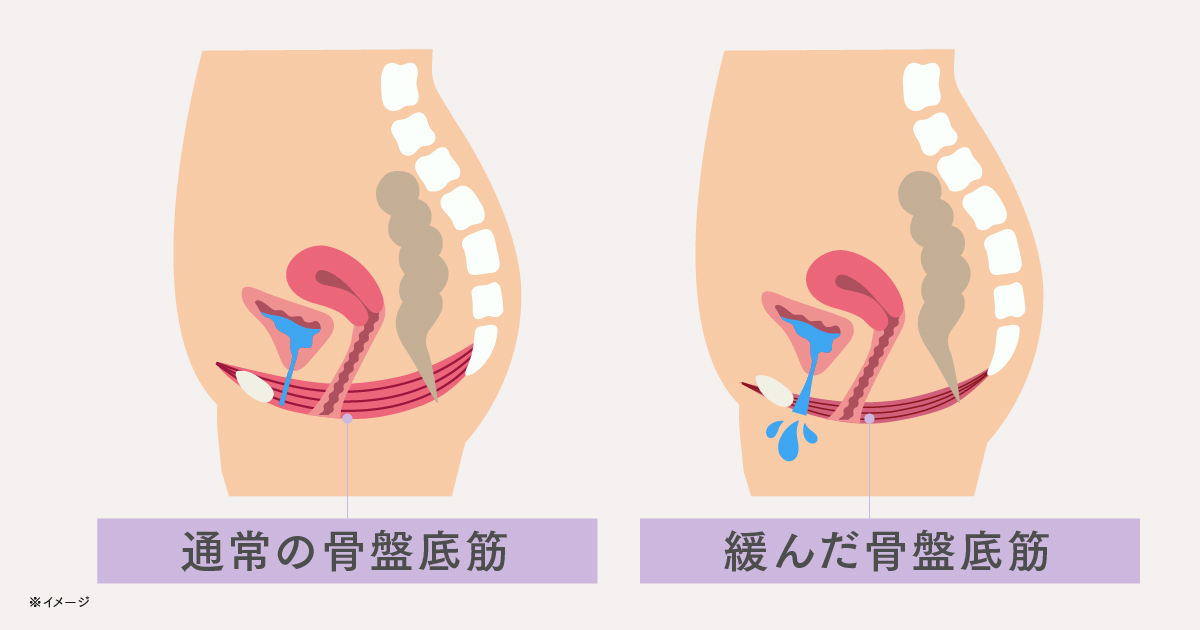 今注目の骨盤底筋トレーニングを毎日のお風呂で簡単に。MYTREXより