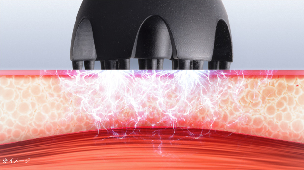 MYTREX EMS HEAD SPA PRO | 電気針ヘッドスパMYTREX EMS HEAD SPA PRO -