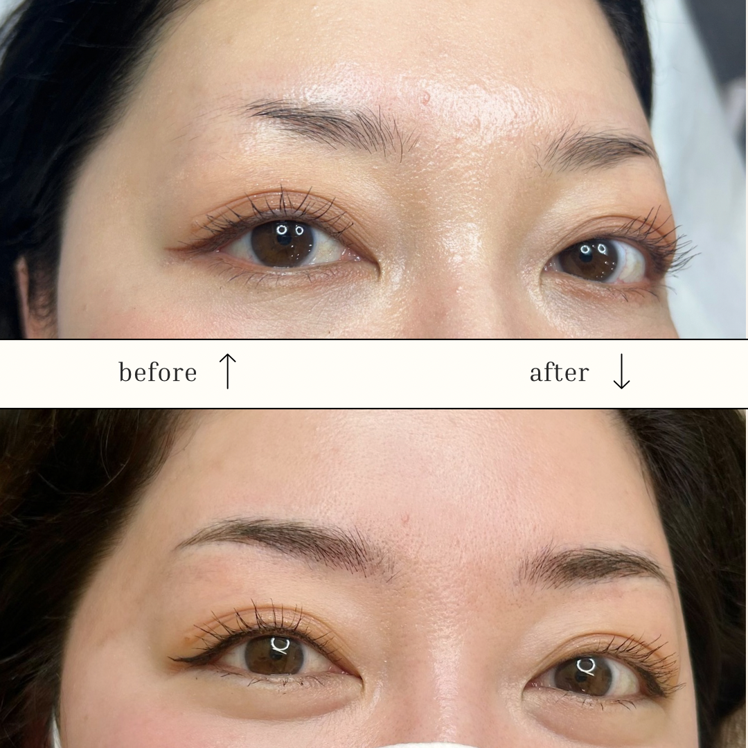 症例紹介】マイクロブレーディング＆マシンシェーディングのMIXアート