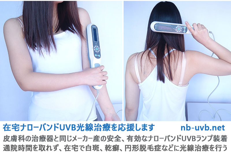 家庭用ナローバンドUVB光線治療器（UVB蛍光管1本搭載） – 家庭用