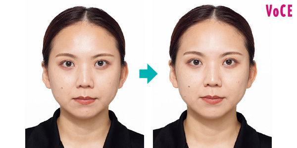 1回使っただけで、むくみが取れてフェイスラインすっきり！ほうれい線