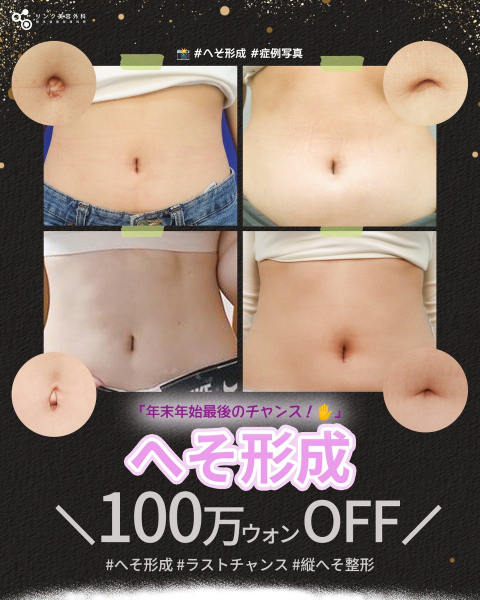 来年こそおへそを隠す生活、終わりにしよう！👙」✨ 年末年始限定の