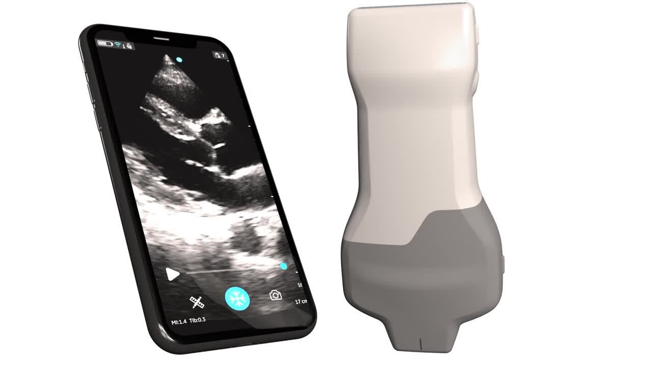 Vscan Air SL | GE HealthCare (Japan)