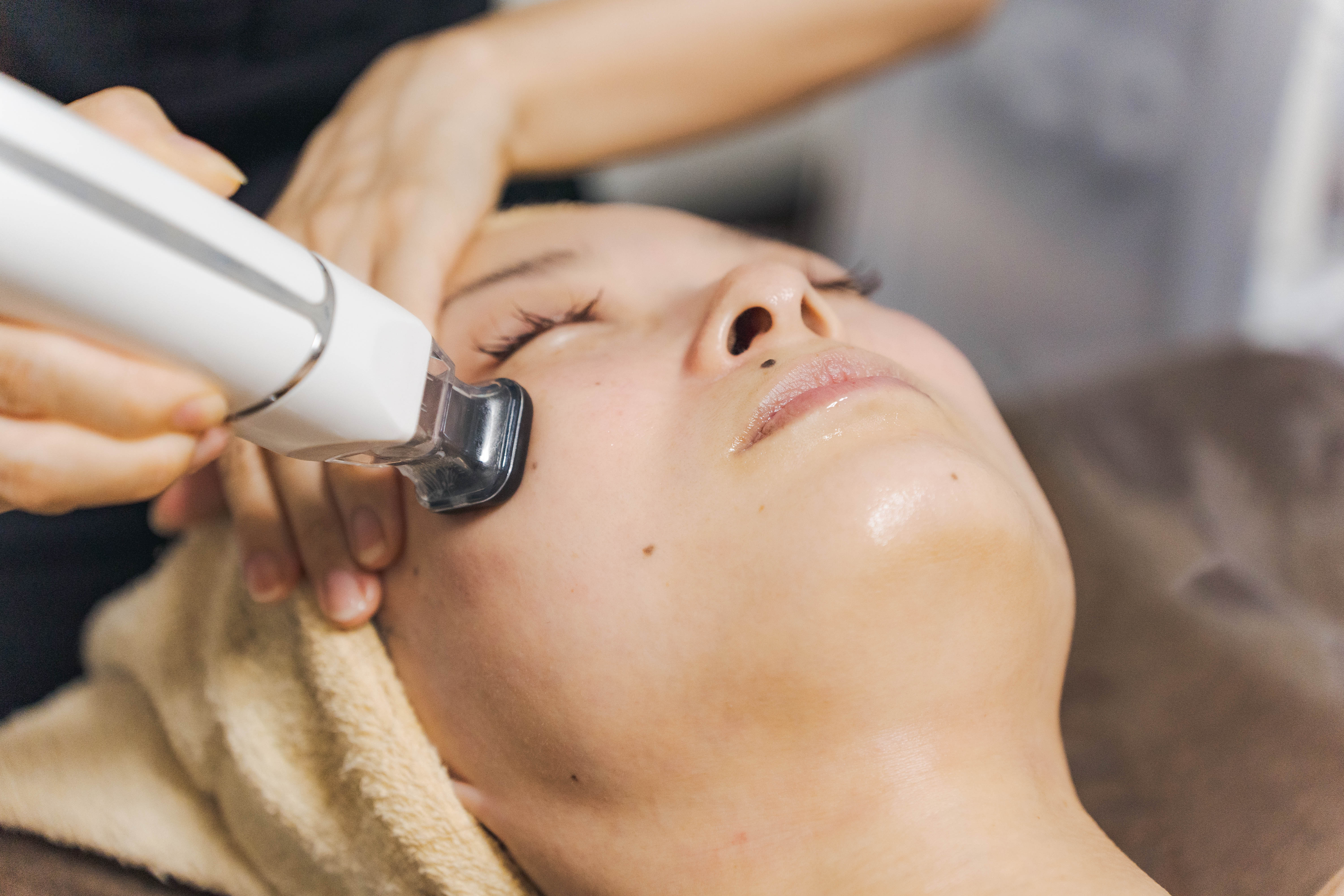 サーマルフラクショナルで、若返りを手に入れよう！